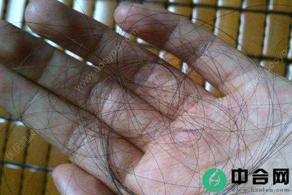 发质不好是怎么回事？这4种发质是你身体在报警(1)